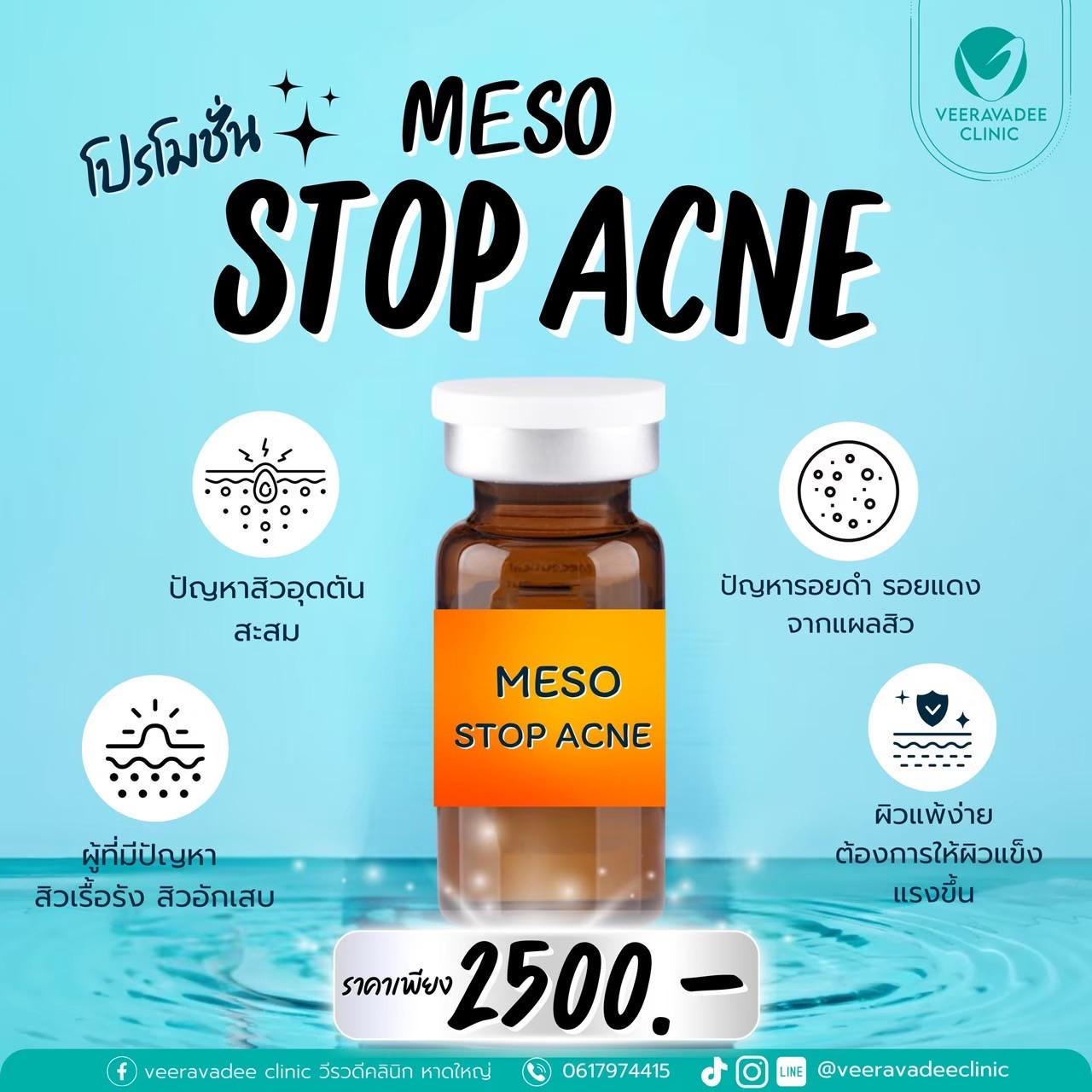 Meso Stop Acne
