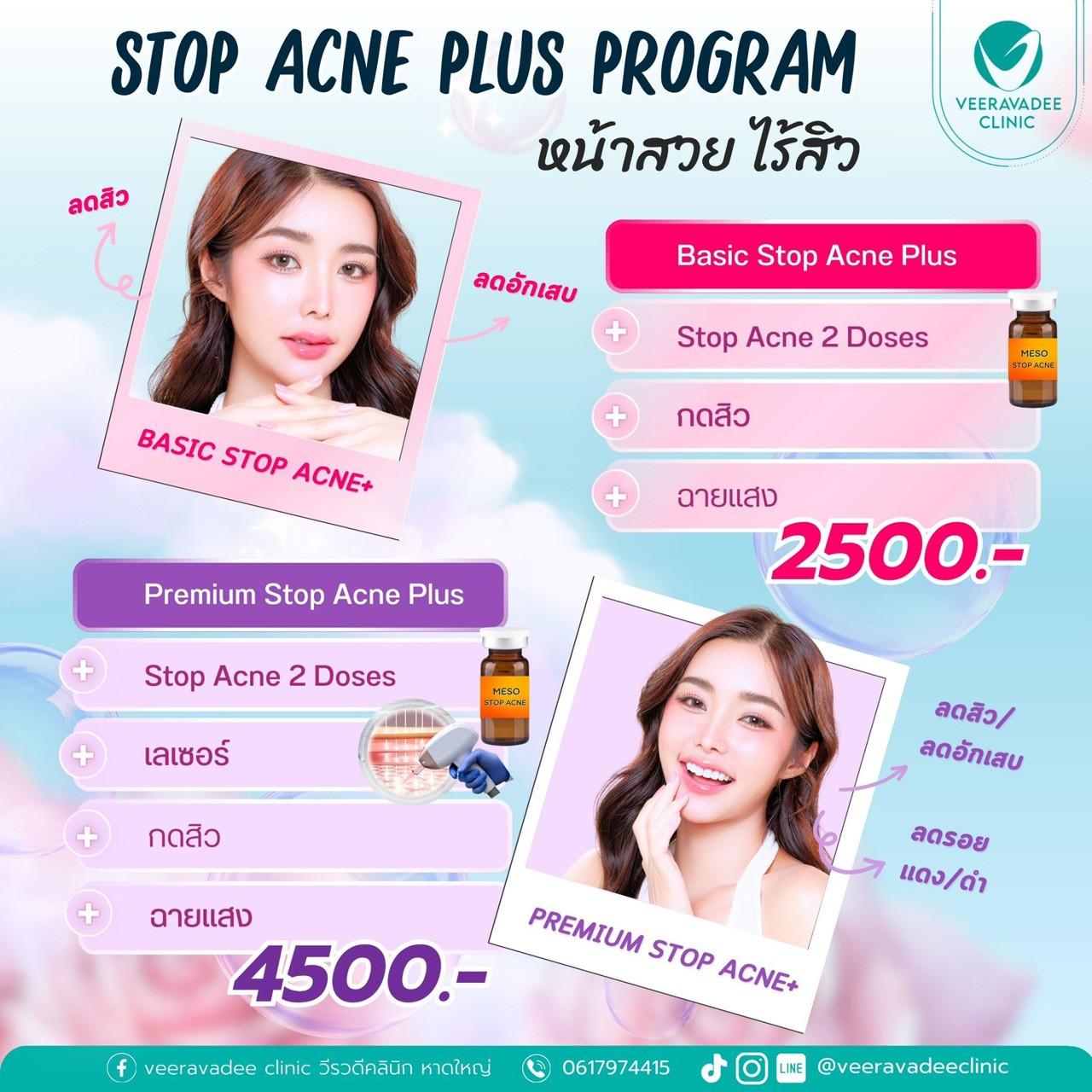 Stop Acne Plus Program