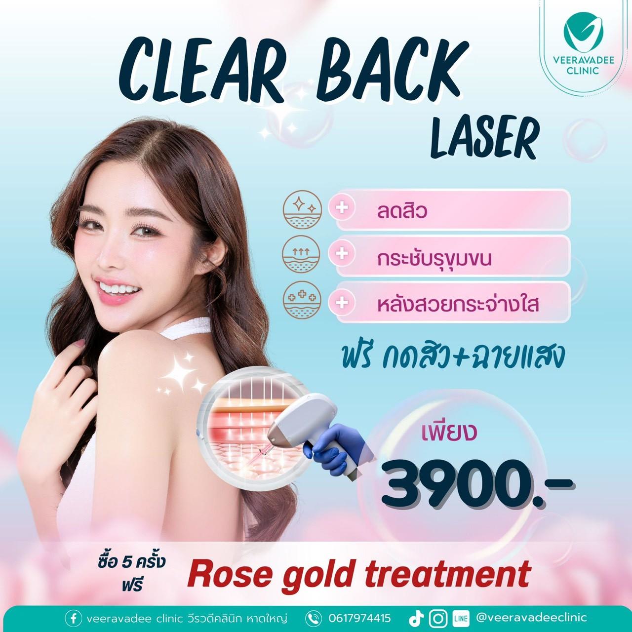 Clear Back Laser