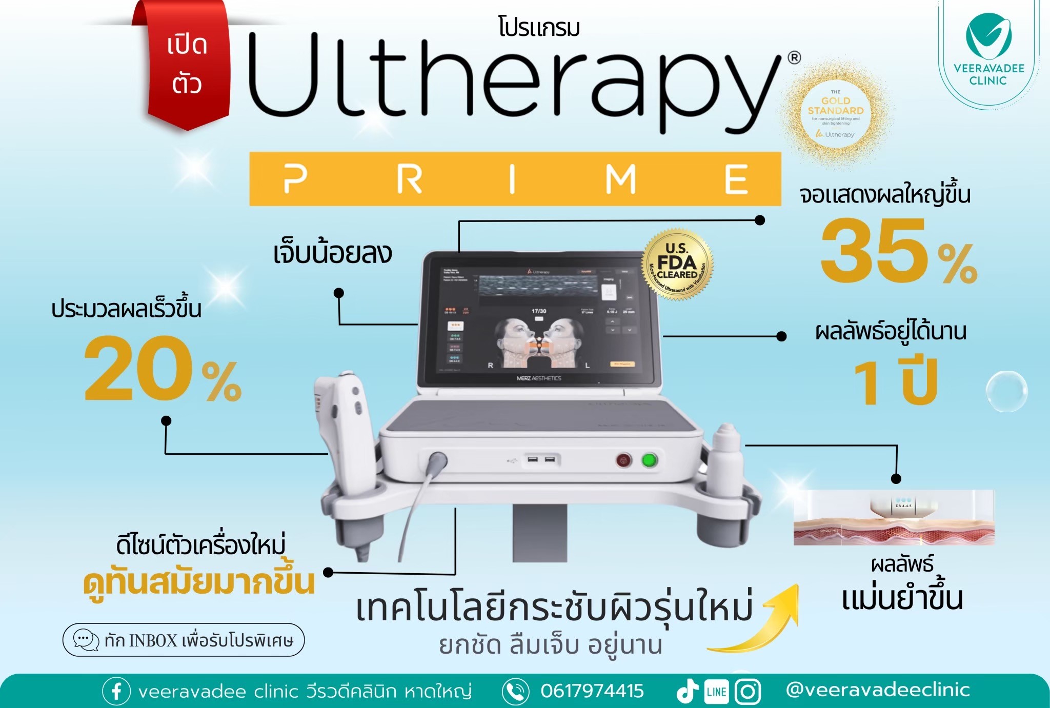 Ultherapy Prime