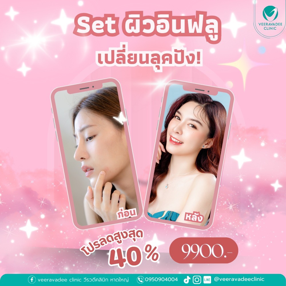 Set ผิวอินฟลู เปลี่ยนลุคปัง!